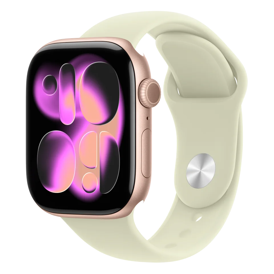 Apple Watch Series 11, фото 1
